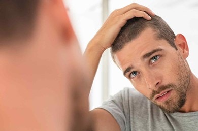 Alopécie chez les hommes